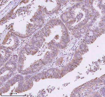 IHC analysis of RBBP8 using anti-RBBP8 antibody. RBBP8 was detected in a paraffin-embedded section o