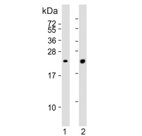 Western blot testing of human 1) lung and 2) K562 cell lysate with Pulmonary surfactant-associated p