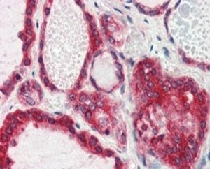 IHC testing of FFPE human thyroid gland with Lipin 3 antibody at 2.5ug/ml. HIER: steamed with pH6 ci