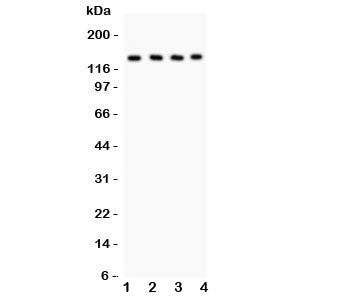 Western blot testing of PLCB1 antibody and Lane 1: rat brain; 2: mouse brain; 3: mouse testis; 4: hu