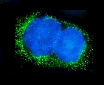 Immunofluorescent staining of FFPE human A431 cells with ALPL antibody (green) and DAPI nuclear stai