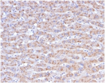 CD40L Antibody / TRAP / CD154