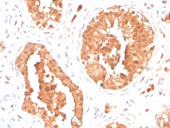 IHC staining of FFPE human testis with DAZL antibody. HIER: boil tissue sections in pH 9 10mM Tris w