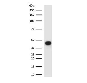 Western blot testing of human lung lysate with EpCAM antibody (clone EPM17-5R). Expected molecular w