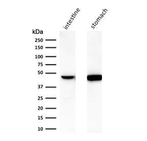 Cytokeratin 18 Antibody