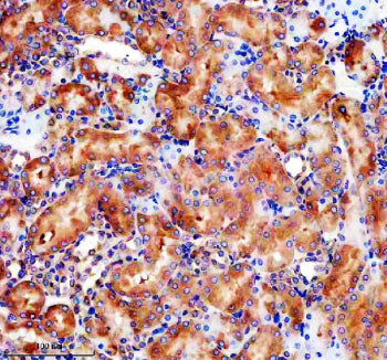 IHC staining of FFPE rat kidney tissue with GLB1 antibody, HRP-secondary and DAB substrate. HIER: bo