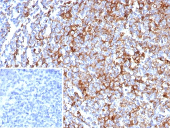 IHC staining of FFPE human tonsil tissue with CD63 antibody (clone rLAMP3/8604). Inset: PBS used in 