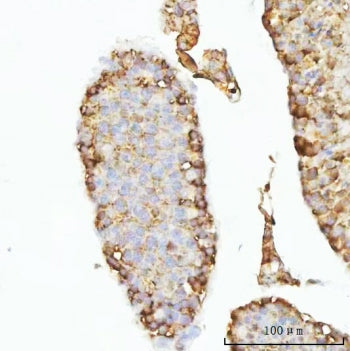 IHC staining of FFPE mouse testis tissue with GHRH antibody. HIER: boil tissue sections in pH8 EDTA 