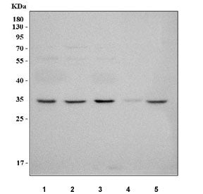 Western blot testing of 1) human 293T, 2) human ThP-1, 3) human K532, 4) rat testis and 5) mouse tes