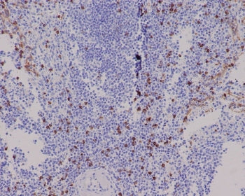 IHC staining of FFPE human spleen tissue with CD8 alpha antibody. HIER: boil tissue sections in pH6,