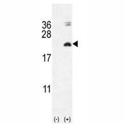 IL17F Antibody