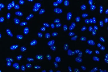 WDR3 Antibody / WD repeat-containing protein 3