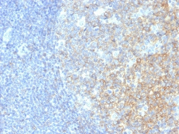 IHC testing of human tonsil with CD40 antibody (clone C40/2383). HIER: boil tissue sections in pH9 E