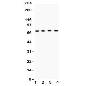 Western blot testing of Kv4.1 antibody and Lane 1: mouse brain; 2: human HeLa; 3: (h) COLO320; 4: (h