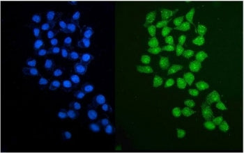 Immunofluorescent staining of FFPE human HepG2 cells with PARP2 antibody (green) and DAPI nuclear st