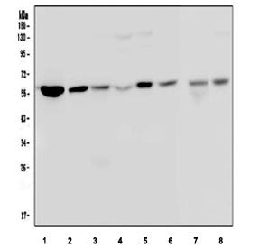 Optineurin Antibody / OPTN, 100ug
