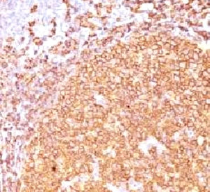 IHC staining of FFPE human tonsil tissue with CD20 antibody (clone CDLA20-1). HIER: boil tissue sect