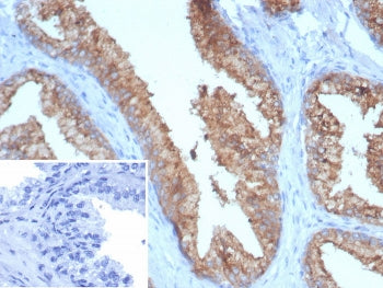 IHC staining of FFPE human prostate tissue with TMPRSS2 antibody (clone TMPRSS2/7410). Inset: PBS us