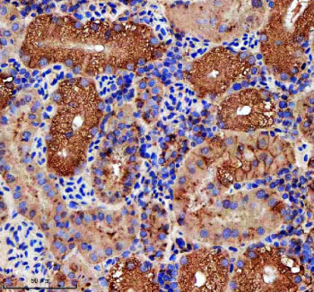 IHC staining of FFPE zebrafish kidney tissue with Zebrafish Rab3Gap1 antibody. HIER: boil tissue sec