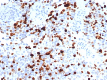 IHC staining of FFPE human lymph node tissue with Topo IIa antibody (clone TOP2A/7148R). HIER: boil 