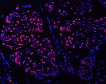 SMC6 Antibody / Structural maintenance of chromosomes protein 6