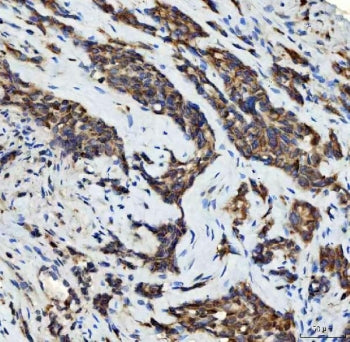 STK15 Antibody / Serine/threonine-protein kinase 15 / AURKA