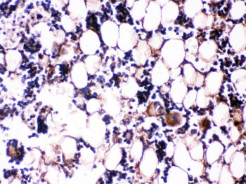 IHC testing of FFPE rat bone tissue with Osteocalcin antibody. HIER: Boil the paraffin sections in p