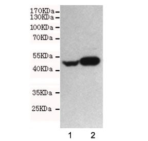 Western blot testing of human 1) SHSY-5Y and 2) U87-MG cell lysates using Neuron Specific Enolase an