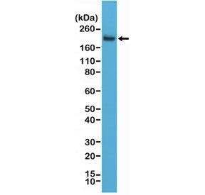 Western blot testing of human Jurkat cell lysate using recombinant CD45 antibody at a 1:2000 dilutio