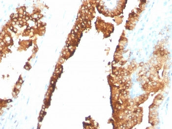 CDw75 Antibody