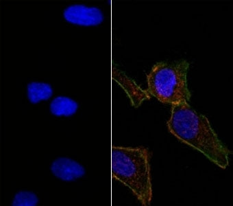 EpCAM Antibody
