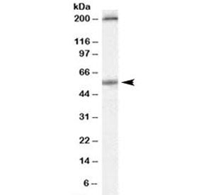Western blot testing of human colon lysate with Serotonin receptor 3A antibody at 0.3ug/ml. Both the