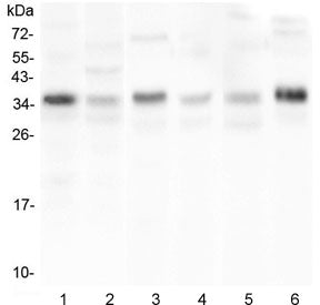 Western blot testing of 1) human HL-60, 2) human U-87 MG, 3) rat liver, 4) rat stomach, 5) mouse spl
