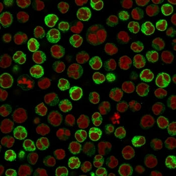 CD79a Antibody