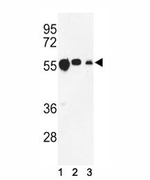 beta Tubulin Antibody