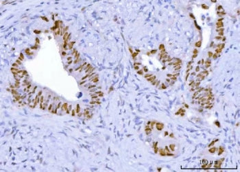 TP53 Antibody / Cellular tumor antigen p53