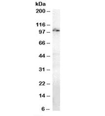 Western blot testing of mouse brain lysate with Anillin antibody at 1ug/ml. Predicted molecular weig