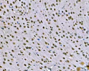 IHC staining of FFPE mouse brain tissue with SNRPN antibody. HIER: boil tissue sections in pH8 EDTA 