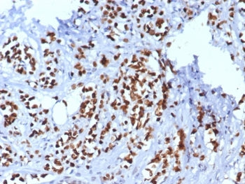 IHC staining of FFPE human breast tissue with TRPS1 antibody (clone TRPS1/8008R). HIER: boil tissue 