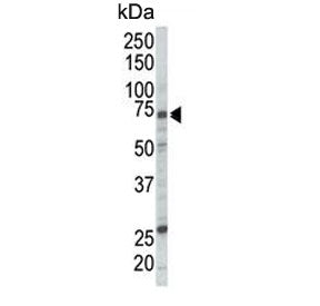 Western blot testing of human Jurkat cell lysate with RAF1 antibody. Predicted molecular weight ~73 