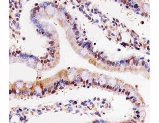 Cdk4 Antibody