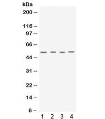 Western blot testing of 1) mouse testis, 2) mouse skeletal muscle, 3) human MCF7 and 4) human A549 l
