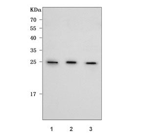 REXO2 Antibody / RNA exonuclease 2