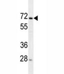 MIPEP Antibody / Mitochondrial intermediate peptidase, 0.08ml