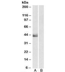 Western blot testing of human placenta lysate with SERPINB1 antibody at 0.5ug/ml with [B] and withou
