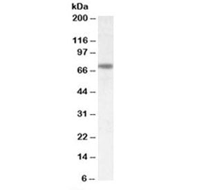 Western blot testing of rat brain lysate with Netrin 1 antibody at 0.5ug/ml. Expected molecular weig