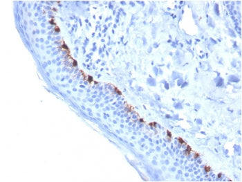 IHC staining of FFPE human skin with TRP1 antibody (clone TYRP1/3284). HIER: boil tissue sections in