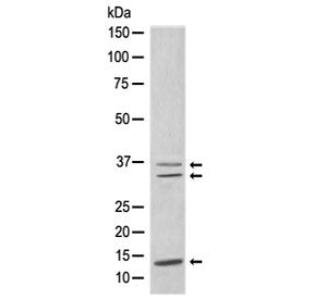 Western blot testing of human MCF7 cell lysate with CEBPB antibody. Expected molecular weight: 36-41