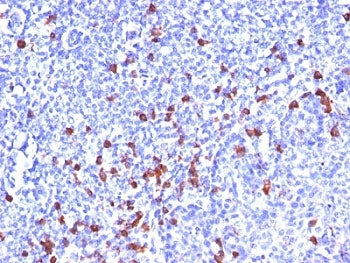IHC: Formalin-fixed, paraffin-embedded human tonsil stained with Kappa Light Chain antibody (clone S