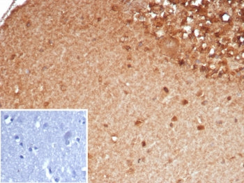 VMAT2 Antibody / SLC18A2